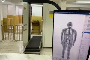 Equipamento de raio-X body scanner moderno em ambiente hospitalar, essencial para inspeção de segurança com radioproteção